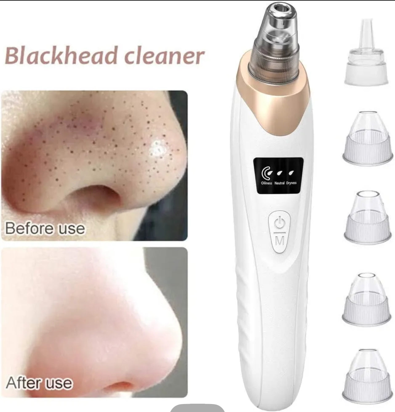 4 in 1 Multi-functional Black Head Removal Machine Derma Suction Machine Blackhead Remover